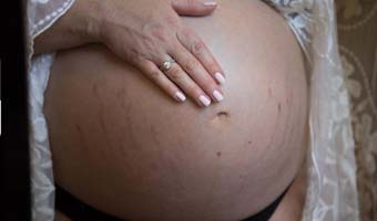 Problèmes de peau durant la grossesse : que faire ?